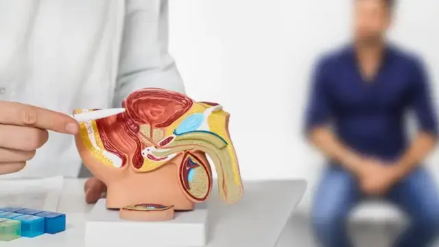 Cáncer de próstata: el cuarto más diagnosticado en el mundo