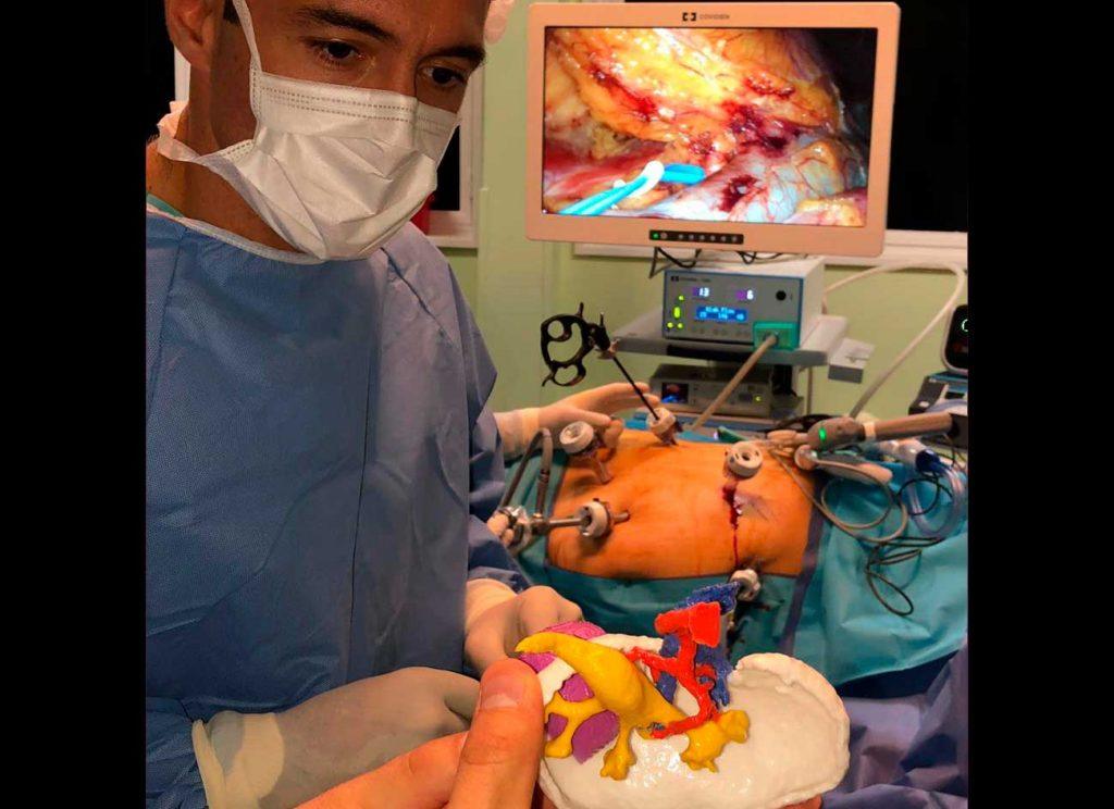Impressão 3D em cirurgia de rim: Dr. Gonzalo Vitagliano, MIRAI 3D