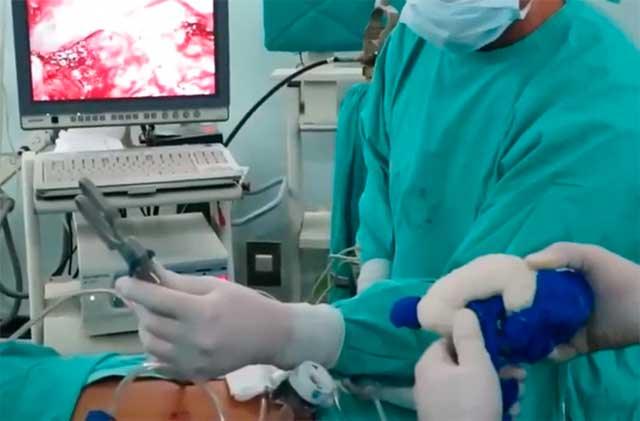 Impressão 3D em cirurgia de rim: Dr. Gonzalo Vitagliano, MIRAI 3D (2/2)