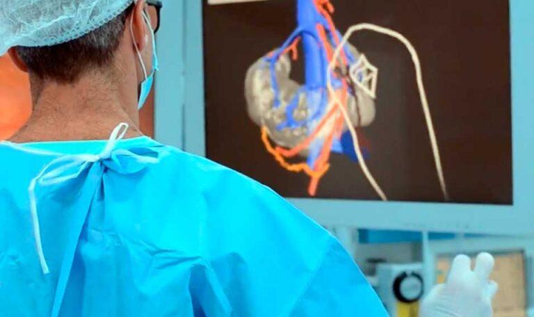 Innovación en cirugía robótica: Navegación 3D touchless