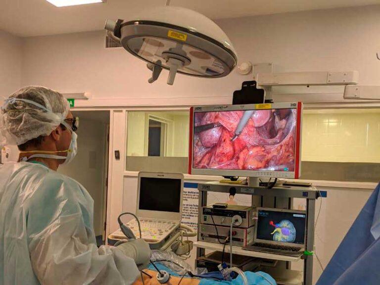 Planificación 3D digital: Nefrectomía parcial laparoscópica