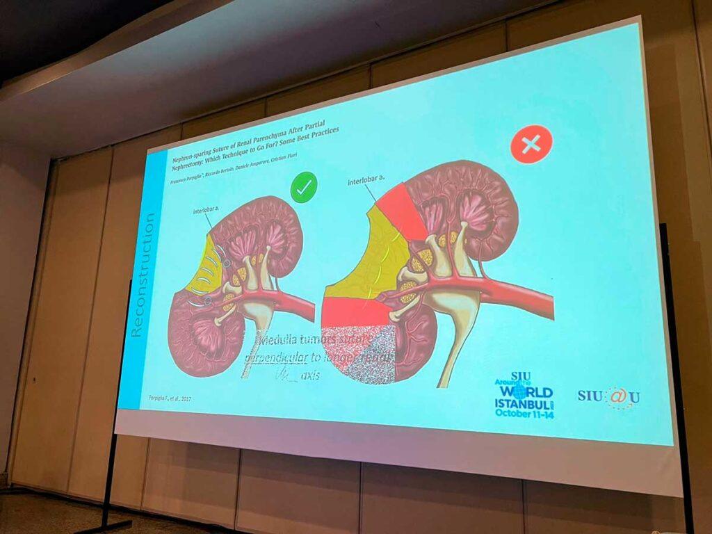 Congresso da Sociedade Internacional de Urologia em Istambul (5/6)
