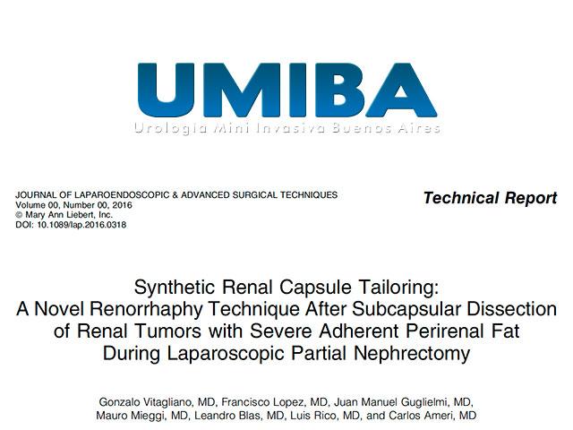 Uma técnica original da UMIBA para nefrectomia parcial laparoscópica é publicada nos EUA