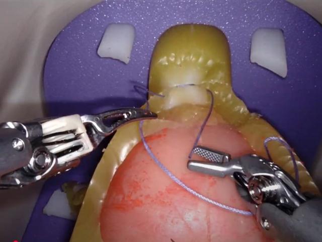 Prostatectomia radical · instrumental ou navegação · detalhe · UMIBA
