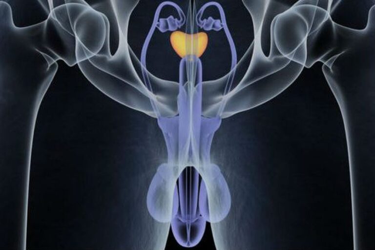 Prostate cancer: prevention is the best ally. Lanacion.com.ar
