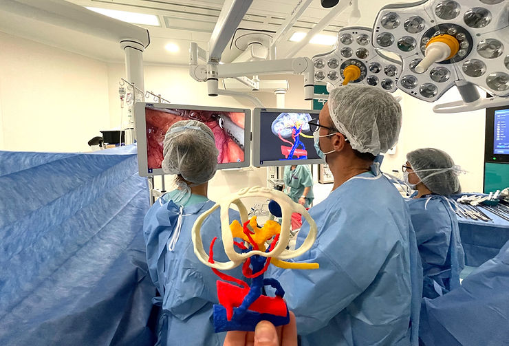 Touchless 3D navigation for complex kidney tumors