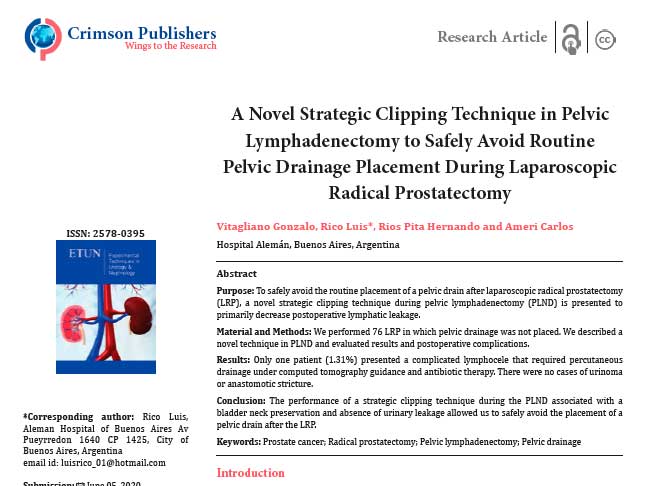 Our original lymphadenectomy technique during laparoscopic radical prostatectomy