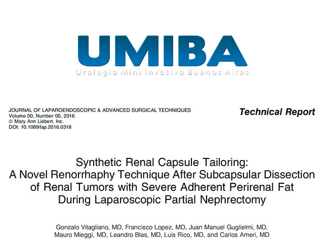 An original UMIBA technique for laparoscopic partial nephrectomy is published in the USA